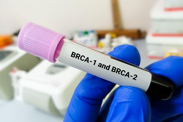Understanding the BRCA Gene and What It Means for Breast Cancer